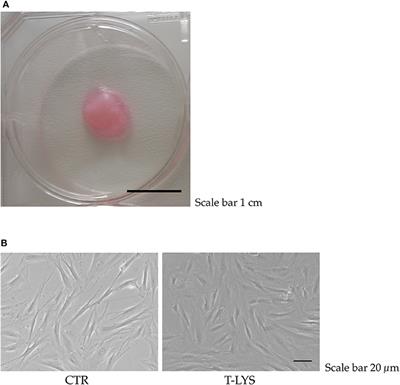 Osteogenic and Chondrogenic Potential of the Supramolecular Aggregate T-LysYal®